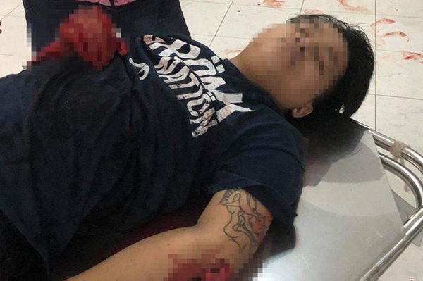 Ráo riết truy bắt nhóm người nổ súng, chém người dã man ở quán nhậu-2