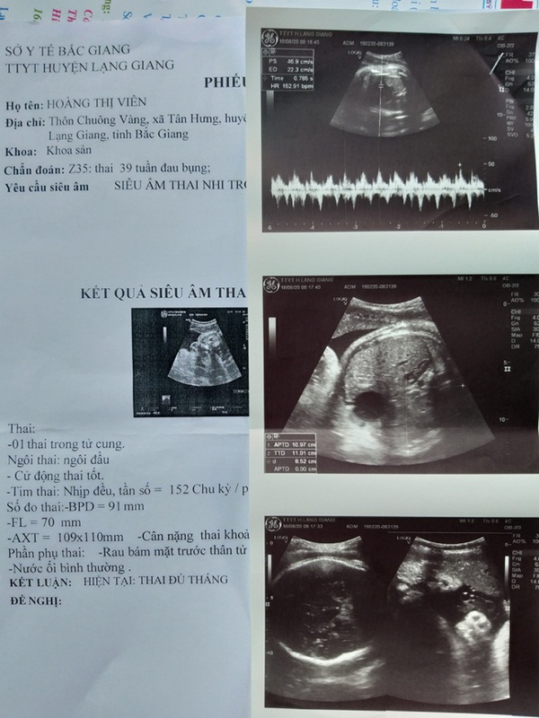 Bắc Giang: Gia đình phẫn nộ đòi làm rõ cái chết của sản phụ sắp sinh con tại trung tâm y tế-3