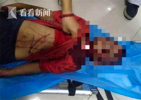 Con trai mất tích, mẹ hốt hoảng kiểm tra camera thang máy thì phát hiện kẻ bắt cóc, hình ảnh đứa trẻ sau khi tìm được vô cùng đau lòng-4