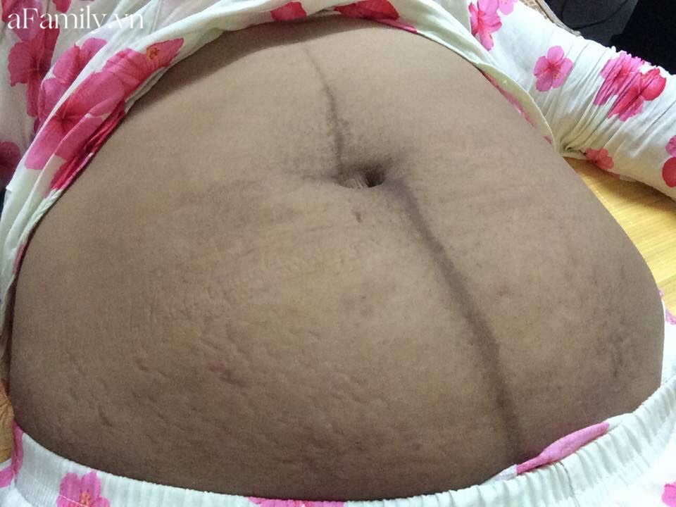 Đẻ xong soi gương mà thấy bế tắc vì quá béo, mẹ Hà Nội lấy lại dáng son nhờ ngày nào cũng ăn món này-4