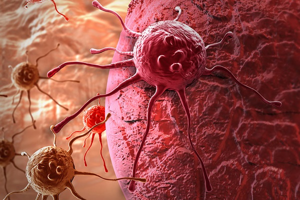 Loại chất độc mà WHO xếp vào nhóm gây ung thư số 1, nấu chín cũng không thể tiêu diệt hóa ra luôn tồn tại ở 4 món đồ này trong bếp nhà bạn-6