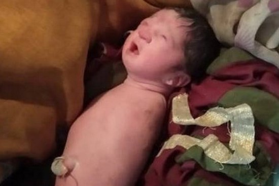 Xuất hiện em bé sinh ra không có cả tay lẫn chân, giống hệt hội chứng mà Nick Vujicic mắc phải