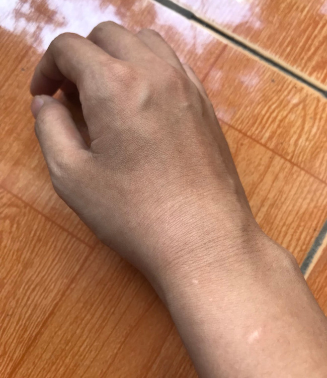 Người vợ đang bế con bị chồng giật tóc ngã ngửa: Tôi từng nghĩ đến chuyện tự tử để kết thúc mọi việc-2