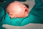 Bé sơ sinh 25 ngày tuổi bị cấu tím bụng để chữa... đầy bụng-2