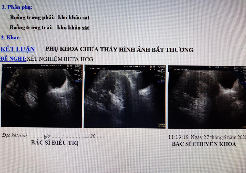 Bác sĩ sản khoa nói gì về trường hợp vác bụng bầu đi đẻ nhưng thực chất không hề có thai?-1