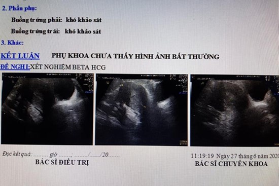 Bác sĩ sản khoa nói gì về trường hợp vác bụng bầu đi đẻ nhưng thực chất không hề có thai?