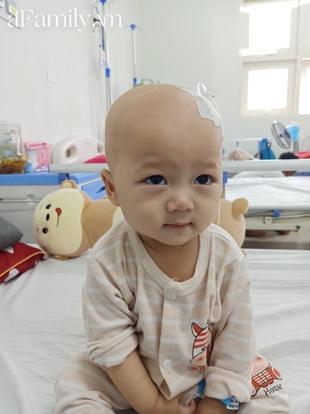 Xót xa bé trai 14 tháng tuổi liền lúc mắc 2 bệnh ung thư, nhìn con cười mà bố mẹ không cầm được nước mắt-2