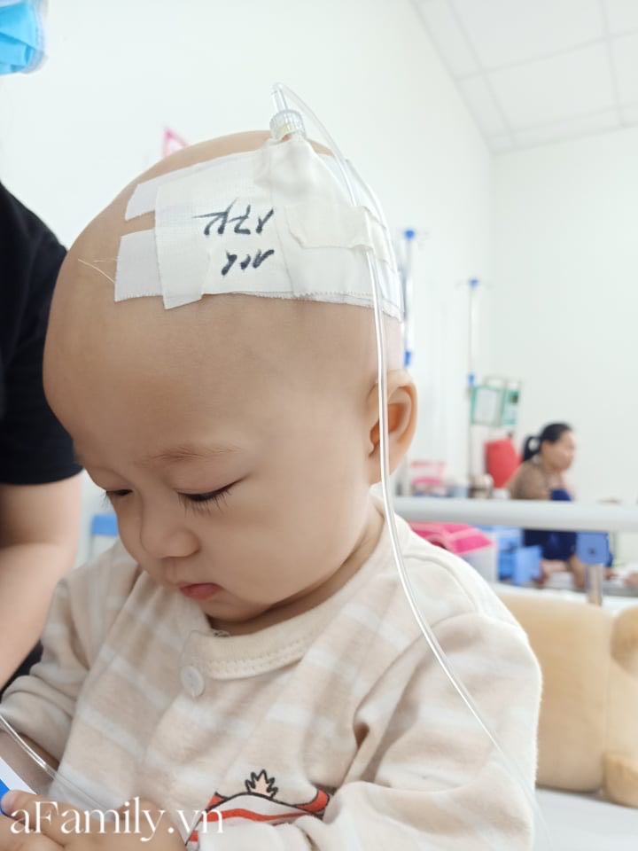 Xót xa bé trai 14 tháng tuổi liền lúc mắc 2 bệnh ung thư, nhìn con cười mà bố mẹ không cầm được nước mắt-3