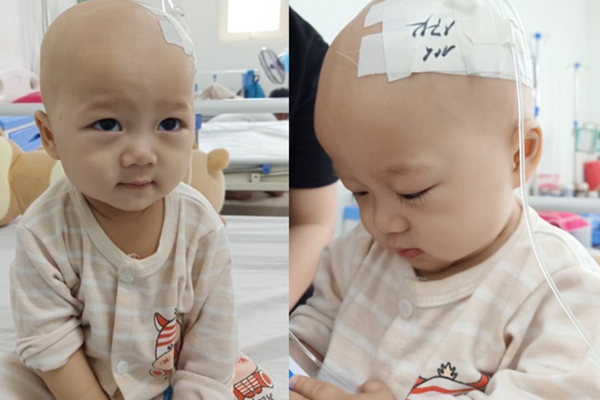 Em bé 14 tháng tuổi mang trong mình 2 loại ung thư: Chừng nào còn được nhìn thấy nụ cười của con, chúng tôi còn cố gắng-7