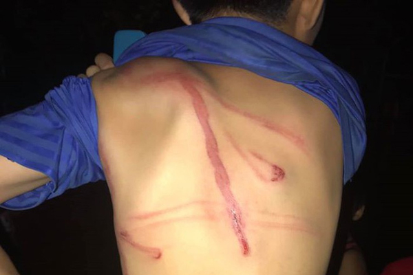 Cha cột dây vào cổ hai con, dùng xe ba gác kéo quanh chợ để… dạy dỗ-3