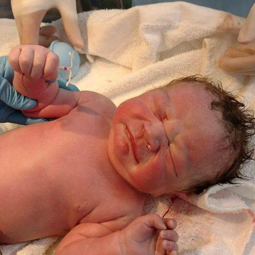 Bé sơ sinh ở Hải Phòng gây sốt khi chào đời với chiếc vòng tránh thai trong tay-4