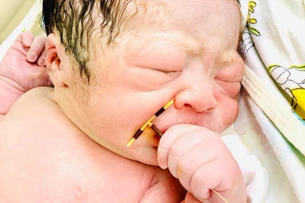 Cặp sinh đôi Đồng Nai gây sốt vì hành trình ra đời như tiểu thuyết: Mẹ 8 năm không dùng biện pháp tránh thai lại tịt, tới lúc dùng thì dính bầu-12