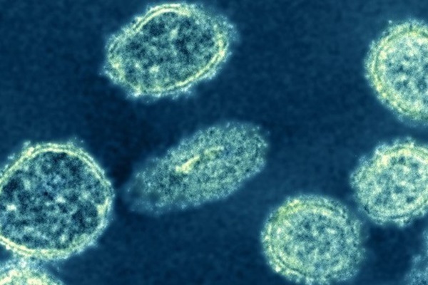 Chuyên gia cảnh báo nguy cơ đại dịch do chủng mới virus H1N1 ở TQ-1