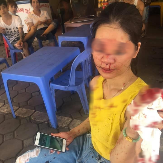 Đi tìm sự thật thông tin nữ khách hàng bị thẩm mỹ viện Venus gọi giang hồ đánh chảy máu mặt vì đòi bảo hành-1