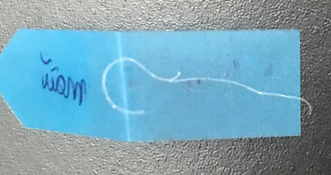 Đi tìm sự thật thông tin nữ khách hàng bị thẩm mỹ viện Venus gọi giang hồ đánh chảy máu mặt vì đòi bảo hành-2