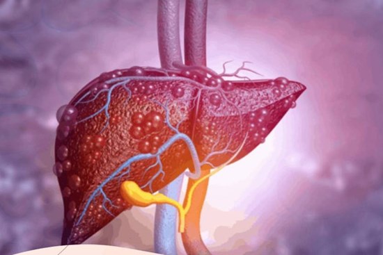 Trước khi gan bị tổn thương, cơ thể sẽ phát ra 3 tín hiệu quan trọng bạn nên biết