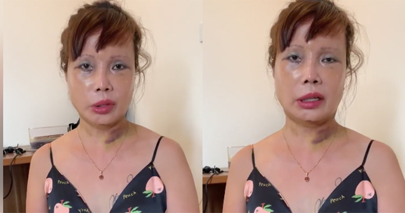 Tuyên bố chết cũng phải làm con ma đẹp, cô dâu Cao Bằng tiết lộ chuẩn bị nâng ngực-3