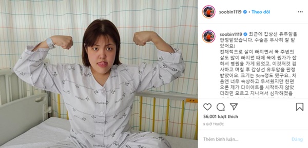 Ung thư tuyến giáp ngày càng trẻ hoá: thấy 6 điểm bất thường này xung quanh vùng cổ thì bạn nên đi khám ngay-1