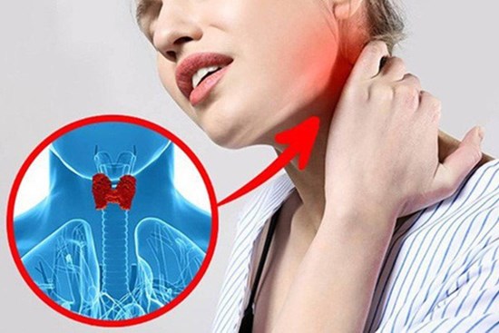 Ung thư tuyến giáp ngày càng trẻ hoá: thấy 6 điểm bất thường này xung quanh vùng cổ thì bạn nên đi khám ngay