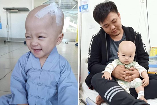 Em bé 14 tháng tuổi mang trong mình 2 loại ung thư: