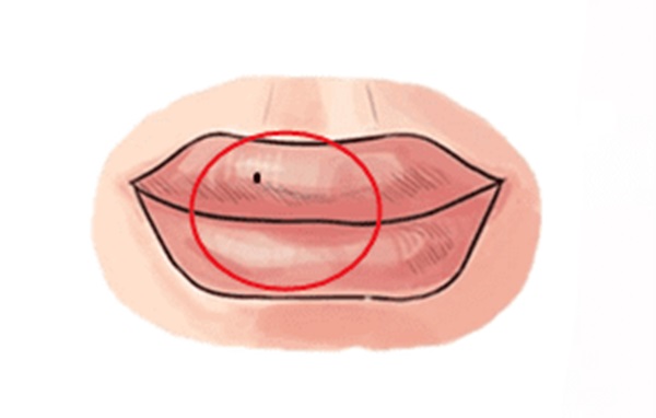 4 nốt ruồi cay đắng trên mặt phụ nữ, hôn nhân thường trục trặc, dễ cô đơn cả đời-4