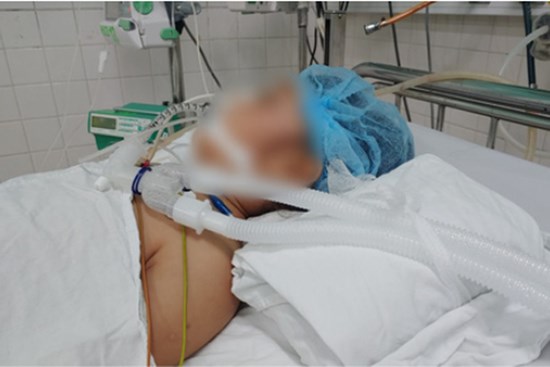 Nghi vấn bé 9 tuổi bị mẹ dùng kéo đâm thủng tim nguy kịch, người nhà nói cháu từng bị mẹ đánh đập nhiều lần