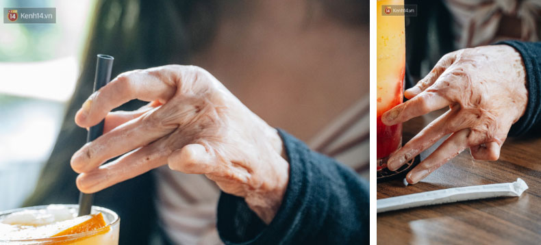 Gặp cô giáo xinh đẹp bị bỏng nặng do nổ bóng bay: Mình vẫn đang sống và càng phải sống mạnh mẽ hơn bất cứ lúc nào-5