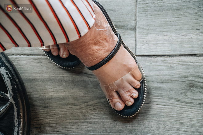 Gặp cô giáo xinh đẹp bị bỏng nặng do nổ bóng bay: Mình vẫn đang sống và càng phải sống mạnh mẽ hơn bất cứ lúc nào-4