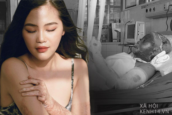 Chàng trai cháy cả gương mặt mở tiệm bánh bán... tình yêu-8