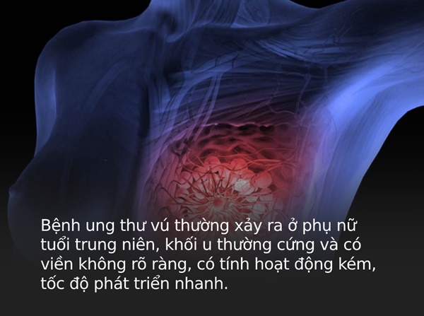 4 loại ung thư dễ chẩn đoán sai nhất, có thể chỉ khác nhau ở một chi tiết cực kỳ nhỏ-3