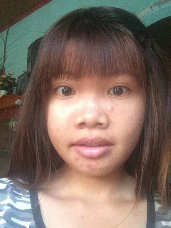 Sau nhiều năm dao kéo, Phượng Thị Nở đăng đàn chuyện bị chế giễu bởi quá khứ kém xinh-2