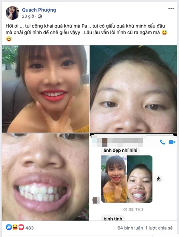 Sau nhiều năm dao kéo, Phượng Thị Nở đăng đàn chuyện bị chế giễu bởi quá khứ kém xinh-6