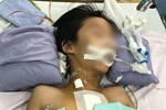 Bé trai 9 tuổi nghi bị mẹ dùng kéo đâm thủng tim đã có thể ăn uống, không dám kể lại sự việc vì sợ-4