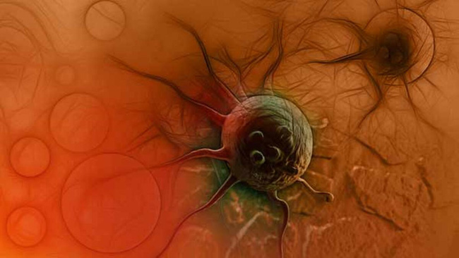 WHO cảnh báo 7 thói quen nguy hiểm trong cuộc sống thúc đẩy ung thư rất nhanh, dù ở độ tuổi nào bạn cũng nên cảnh giác-1