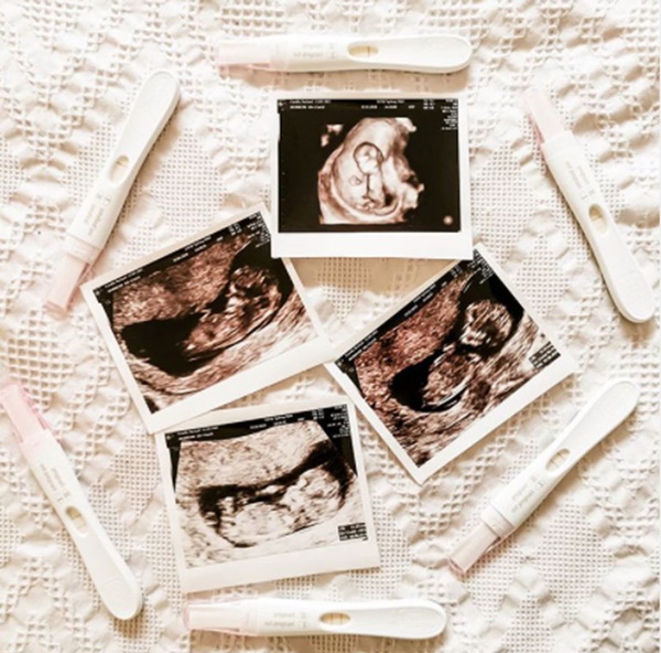 3 lần mất con, bà mẹ lên tiếng nhắc nhở các mẹ về tầm quan trọng của việc sàng lọc trước sinh-6