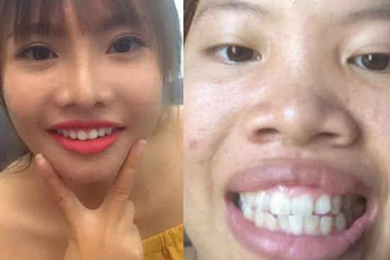 Bị nhắn tin chê bai nhan sắc 