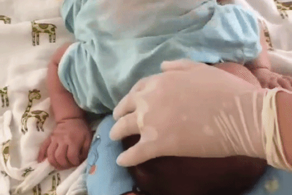 Dân mạng thót tim vì đoạn clip bé sơ sinh bị bác sĩ lấy tay vỗ