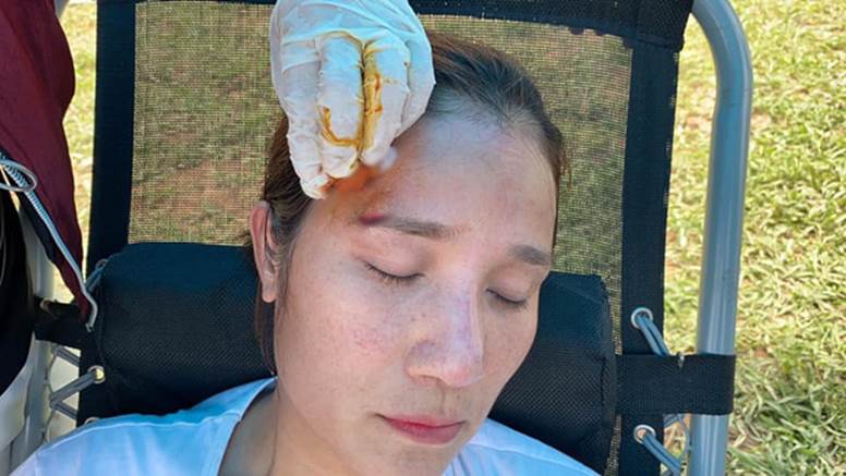 MC Cát Tường gặp chấn thương nặng, phải khâu sống tại chỗ ngay khi đang quay hình-4