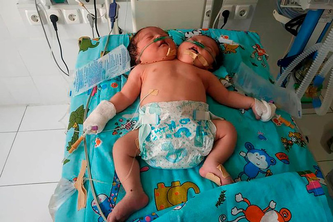 Siêu âm bác sĩ khuyên nên bỏ thai nhưng bố chồng không cho, sinh con ra cả nhà chết lặng-1