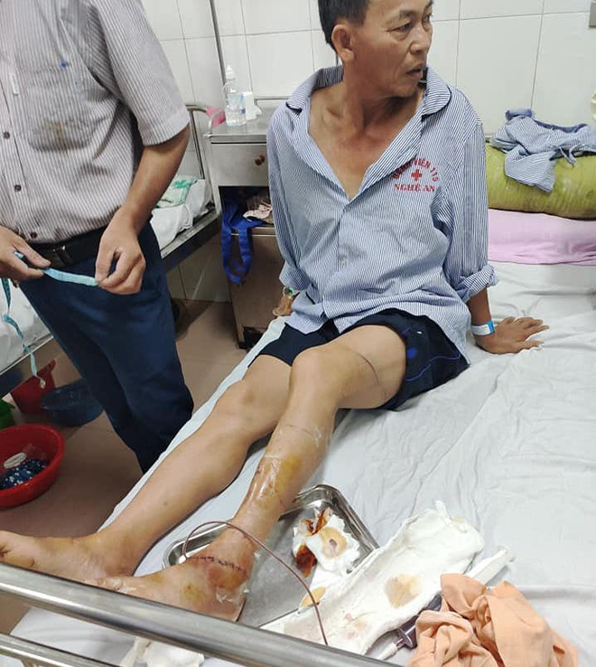 3 bố con chửi bới, ném đá, dùng dao chém đứt gân chân công an-3