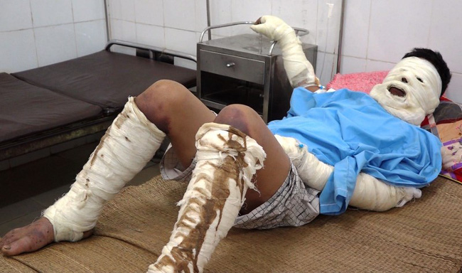 Nam thanh niên bị chặn đường tưới xăng thiêu sống khi đi làm về-1