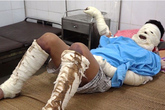 Nam thanh niên bị chặn đường tưới xăng thiêu sống khi đi làm về