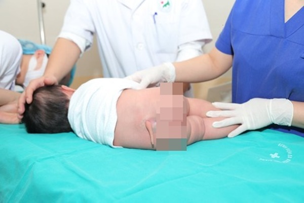Hội chứng khiến bé trai 6 tháng tuổi mọc đuôi 5cm, em bé 11 tháng tuổi có đuôi dài 15cm và ngày càng dài-3