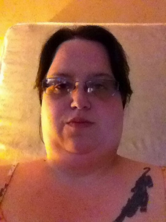 Bà mẹ bị tím bầm cả bụng sau sinh mổ, bác sĩ phải đưa trở lại phòng phẫu thuật khẩn cấp để làm 1 việc-1