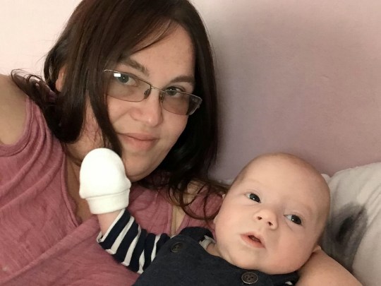 Bà mẹ bị tím bầm cả bụng sau sinh mổ, bác sĩ phải đưa trở lại phòng phẫu thuật khẩn cấp để làm 1 việc-6