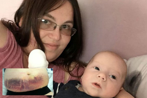 Đã thắt ống dẫn trứng mà vẫn dính bầu, vợ danh hài nổi tiếng sinh mổ 4 lần khiến bác sĩ cũng thót tim-6