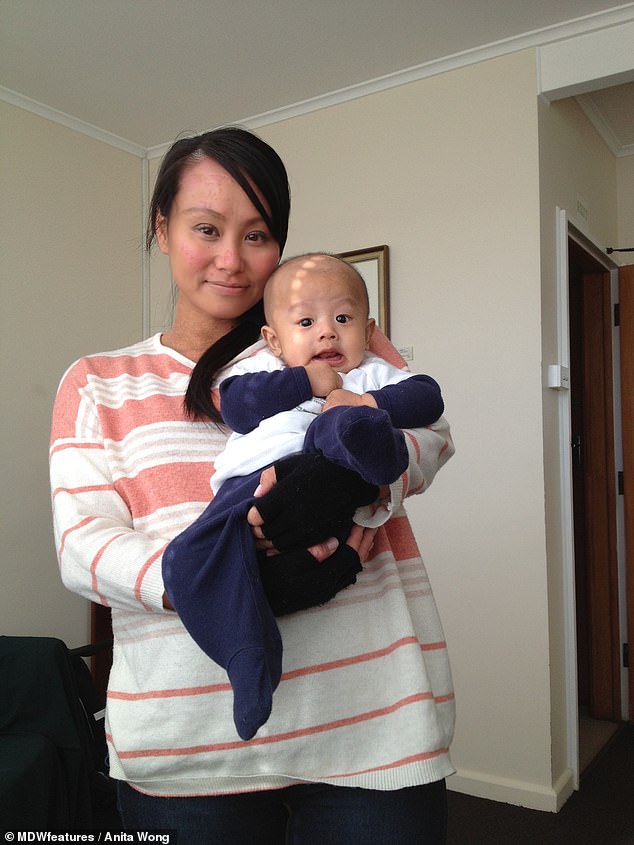 Một người phụ nữ sốc nặng khi nghe mình bị đục thủy tinh thể đến mức hỏng mắt phải vĩnh viễn vì một loại kem bôi ngoài da-3