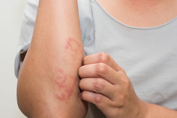 Bác sĩ Bệnh viện K cảnh báo dấu hiệu nhận biết sớm căn bệnh ung thư máu-1