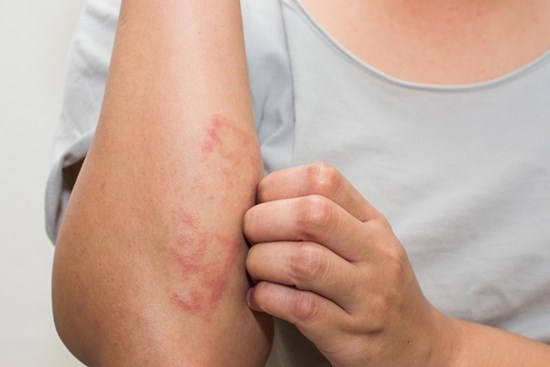 Bác sĩ Bệnh viện K cảnh báo dấu hiệu nhận biết sớm căn bệnh ung thư máu