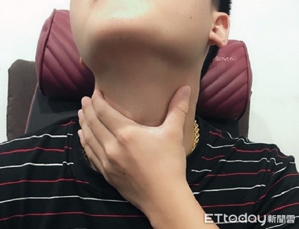 Nấc và táo bón là do rối loạn tiêu hóa, nhưng cũng có thể là dấu hiệu cảnh báo ung thư, chàng trai này là một bệnh nhân trong số đó-1